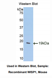 小鼠WNT1诱导信号通道蛋白1(WISP1)多克隆抗体