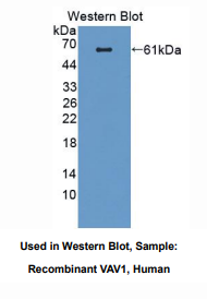 https://msimg.bioon.com/bionline/goods-no-pic.png