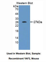 https://msimg.bioon.com/bionline/goods-no-pic.png