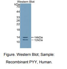 https://msimg.bioon.com/bionline/goods-no-pic.png