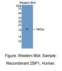 https://msimg.bioon.com/bionline/goods-no-pic.png