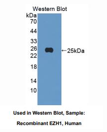 人Zeste同源物增强子1(EZH1)多克隆抗体
