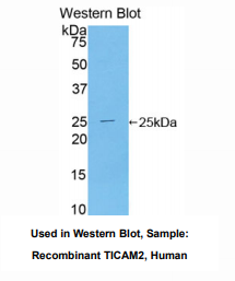 https://msimg.bioon.com/bionline/goods-no-pic.png