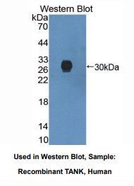 https://msimg.bioon.com/bionline/goods-no-pic.png