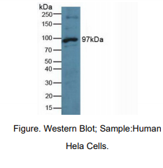 https://msimg.bioon.com/bionline/goods-no-pic.png