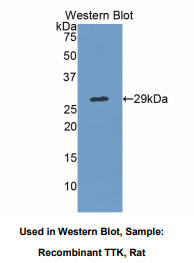 大鼠TTK蛋白激酶(TTK)多克隆抗体