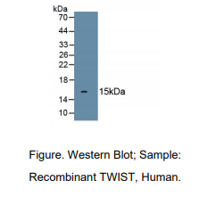 https://msimg.bioon.com/bionline/goods-no-pic.png