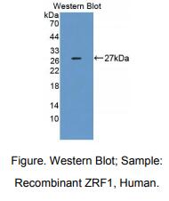 人Zuotin相关因子1(ZRF1)多克隆抗体