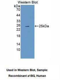 人α1-B-糖蛋白(a1BG)多克隆抗体