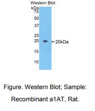 大鼠α1-抗胰蛋白酶(a1AT)多克隆抗体