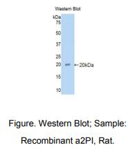 https://msimg.bioon.com/bionline/goods-no-pic.png