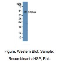 https://msimg.bioon.com/bionline/goods-no-pic.png