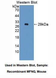 https://msimg.bioon.com/bionline/goods-no-pic.png