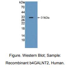 人β-1,4-N-乙酰半乳糖胺基转移酶2(b4GALNT2)多克隆抗体