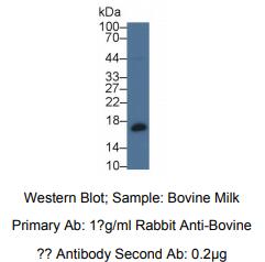 https://msimg.bioon.com/bionline/goods-no-pic.png