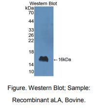 https://msimg.bioon.com/bionline/goods-no-pic.png