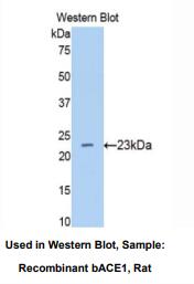 大鼠β-位淀粉样前体蛋白裂解酶1(bACE1)多克隆抗体