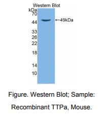 https://msimg.bioon.com/bionline/goods-no-pic.png