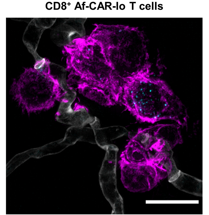Science子刊：新研究表明CAR-T细胞有望用于治疗真菌感染