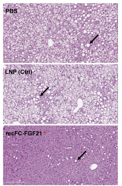 Molecular Therapy: Nucleic Acids皮下注射FGF21 mRNA治疗可逆转饮食诱导肥胖小鼠的肥胖