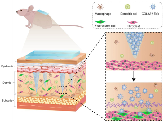 Nature子刊：细胞外囊泡装载mRNA的蛋白质替代疗法：一种全新mRNA递送方法为其他基因疗法打开