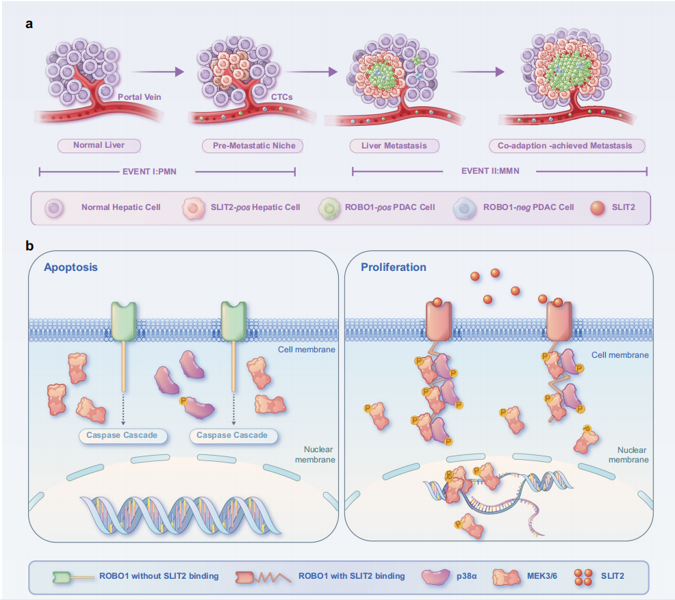 Nat Commun丨张志刚/孙勇伟团队揭示SLIT2-ROBO1轴调控胰腺导管腺癌肝转移的进程