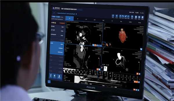 心血管AI进入精准诊断评估时代,数坤科技冠脉CTA AI再获NMPA三类证