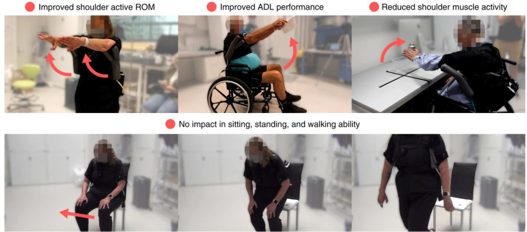 《科学》子刊：ALS患者的“智慧外骨骼”！哈佛科学家开发轻便可穿戴设备，协助ALS患者恢复上肢功能，穿戴负担单侧仅150g插图8