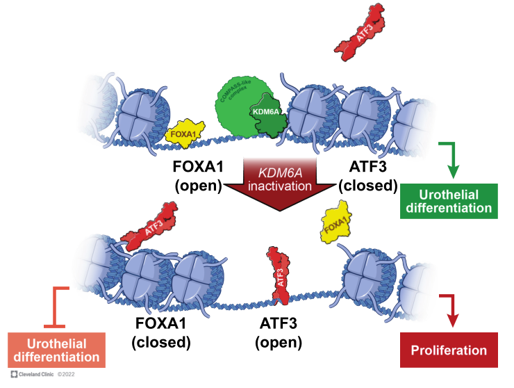 Cancer Res: KDM6A缺失触发表观遗传开关扰乱膀胱癌增殖