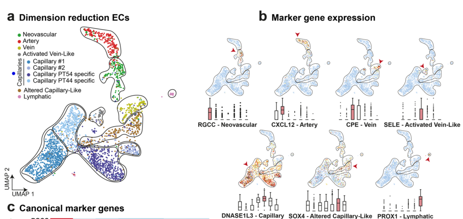 Molecular Cancer: 结直肠癌肝转移分子机制被探明