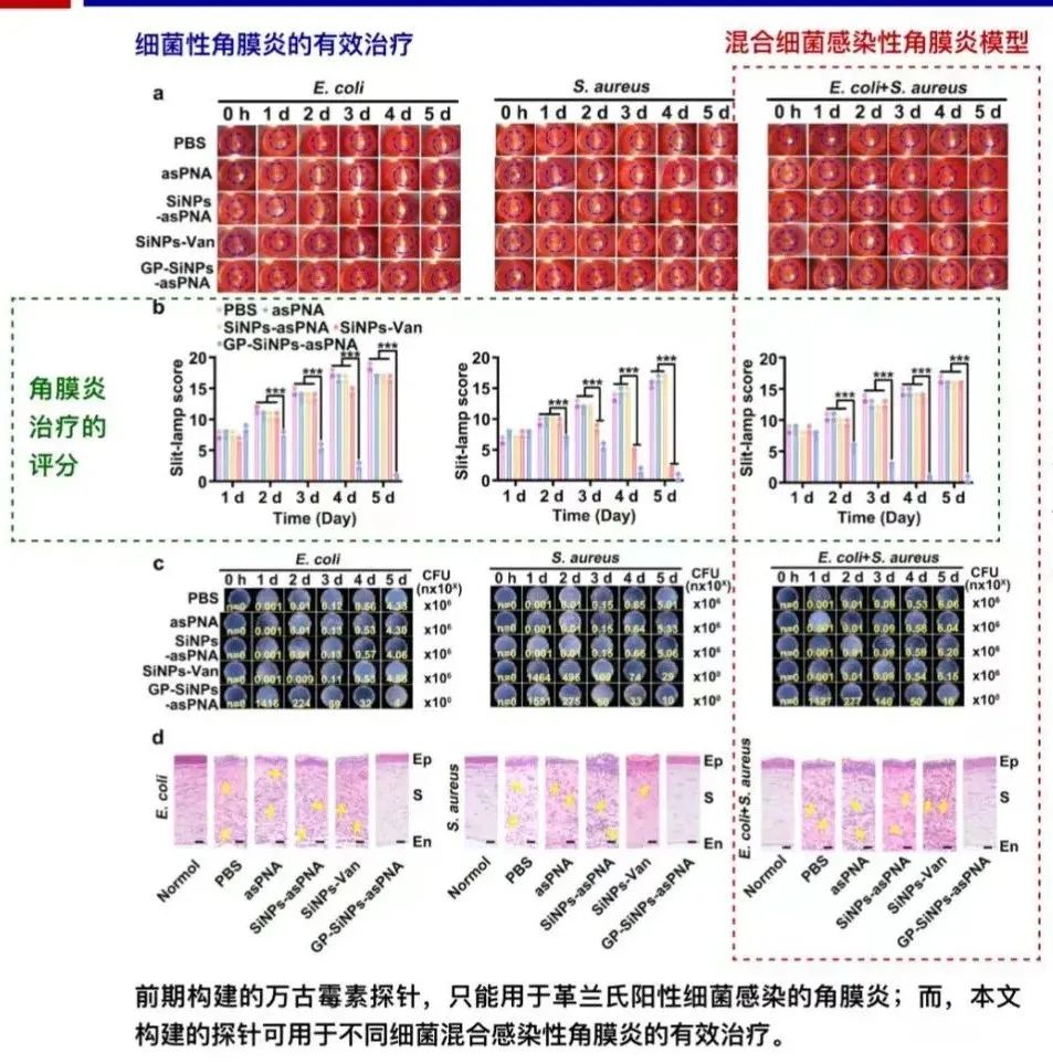 Advanced Materials：洪佳旭/何耀团队在眼科细菌感染性<a href=//www.styjt.com/hangye/jibing/ target=_blank class=infotextkey>疾病</a>中首次实现ASO向人类耐药菌的特异性递送