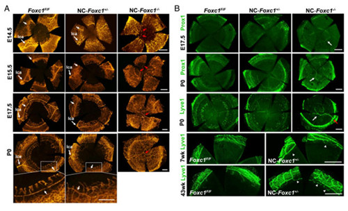 pnas:基因foxc1保护人与小鼠角膜透明性 bioon报道专区 生物谷