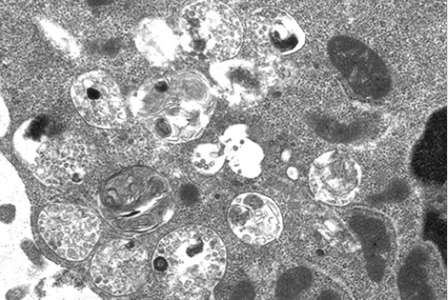 jcb溶酶体中6磷酸甘露糖或可控制b细胞的免疫功能