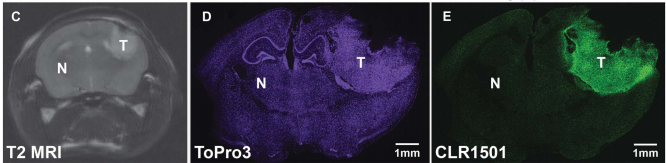 CLR1501处理过的脑胶质母细胞在三种成像技术下的图像
