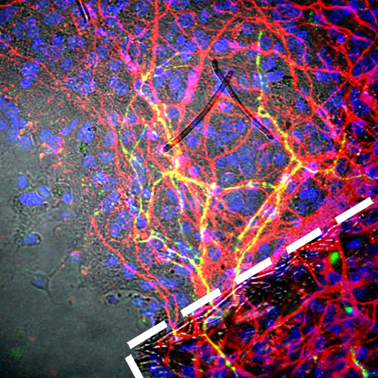 Nature Communications：科学家开发新方法将健康人类神经细胞注入大脑