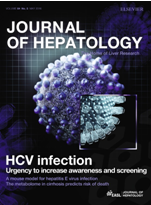 Journal of Hepatology：2型糖尿病增加肝脏疾病风险