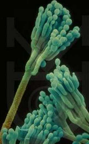 毛霉菌病毒图片图片