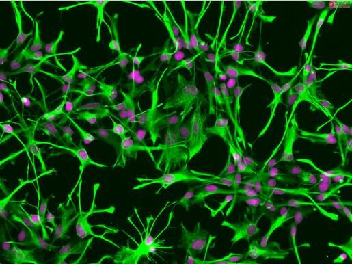 nature探秘星狀細胞的雙面人格或助力神經變性疾病新療法的開發