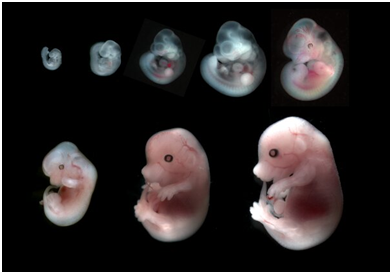 胚胎 真实图片